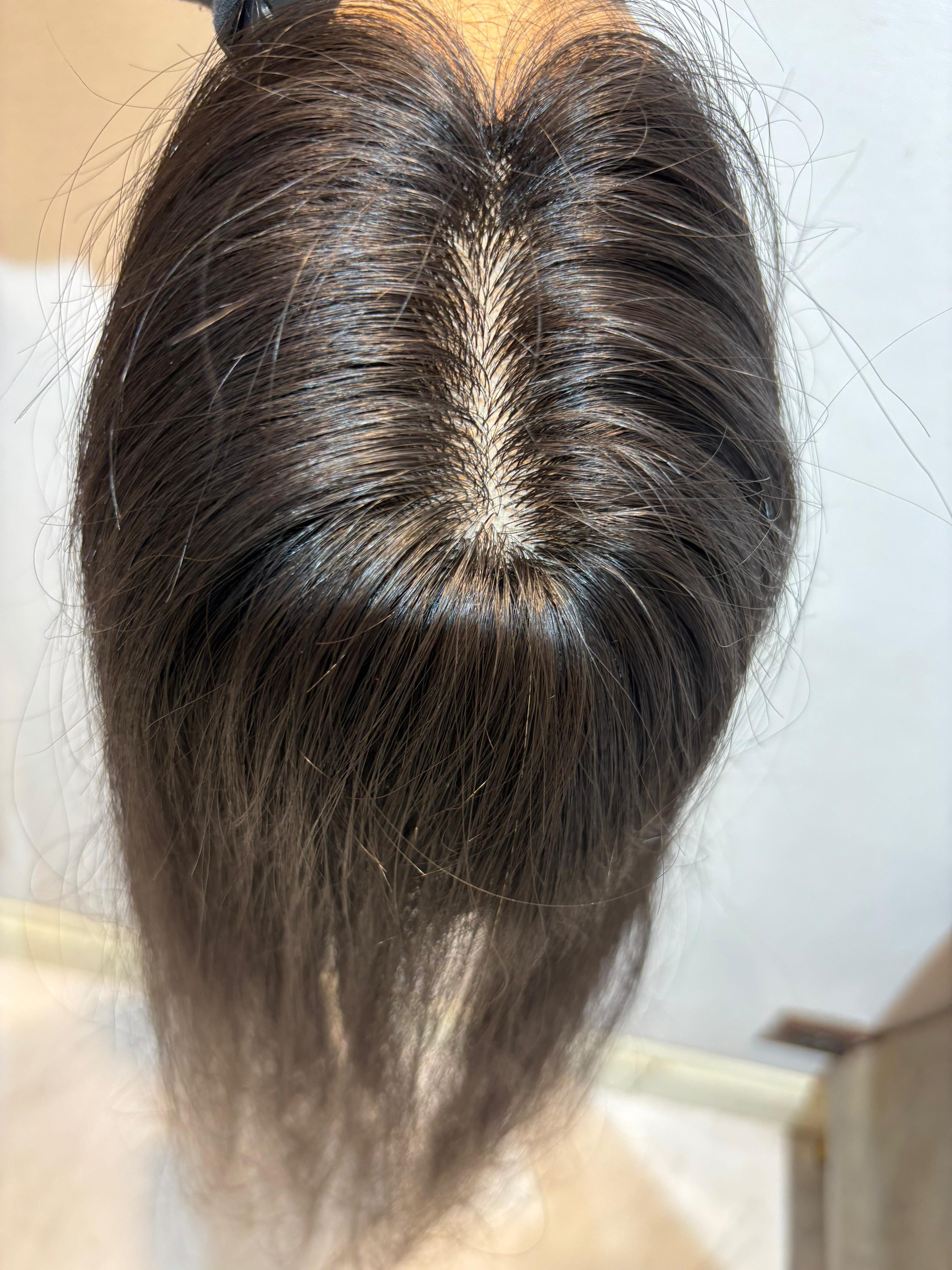 Hair Topper for PCOS Hair Loss | Silk Base | Natural Black | Straight | Remy Hair India